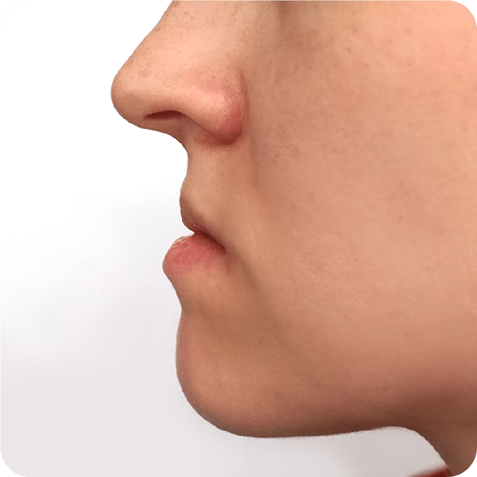 Dentist high-fiving patient